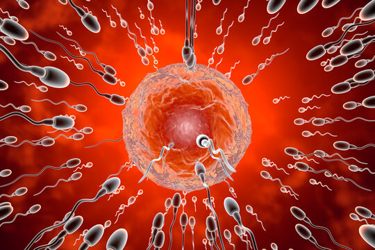 ICSI Treatment