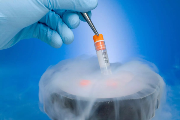 Oocyte Freezing